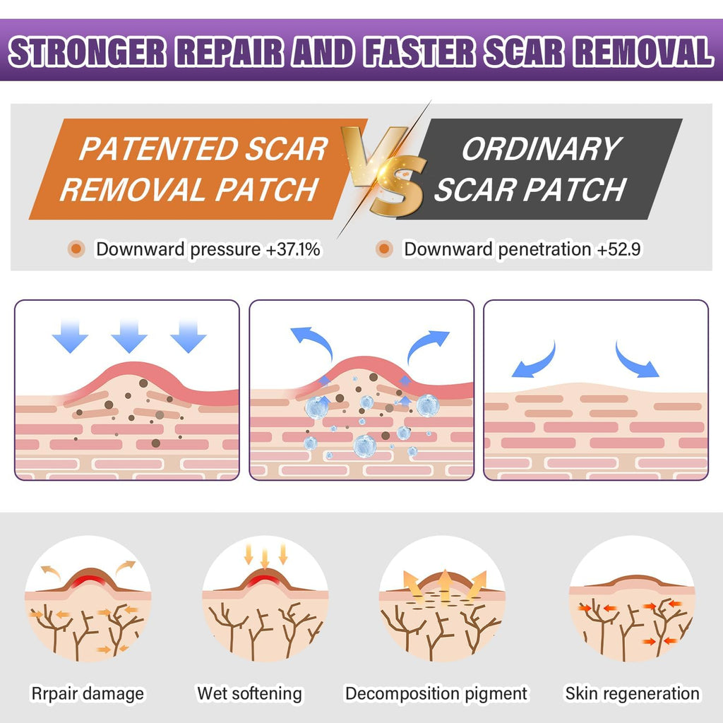 Silicone Scar Care Sheet Roll