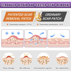 Silicone Scar Care Sheet Roll