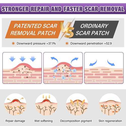 Silicone Scar Care Sheet Roll