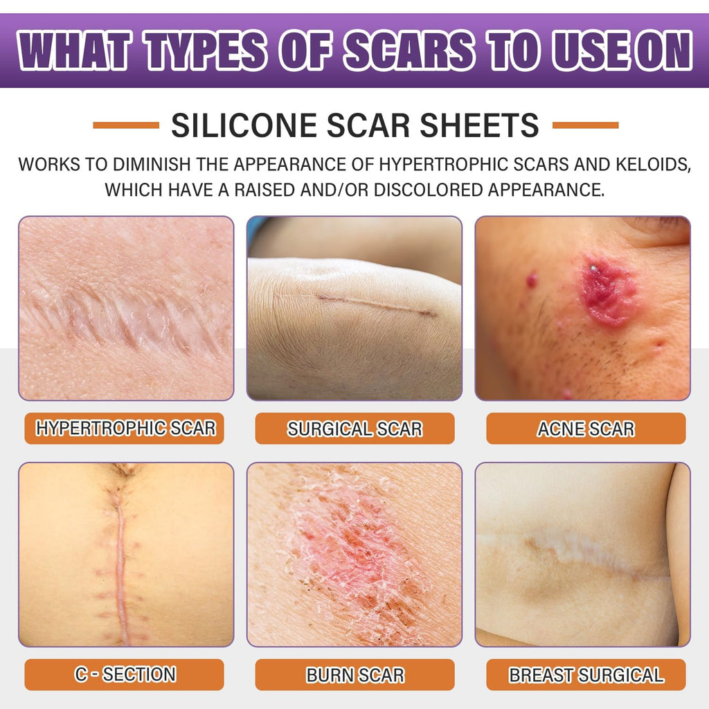 Silicone Scar Care Sheet Roll